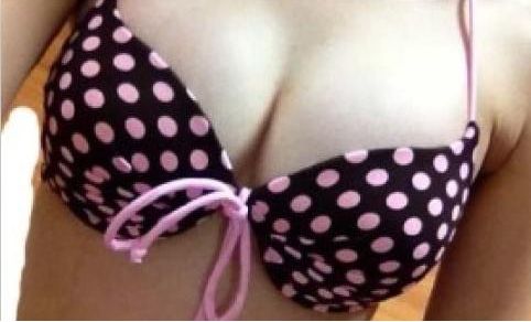 在珠海哪家醫(yī)院割雙眼皮效果好且價格合理？