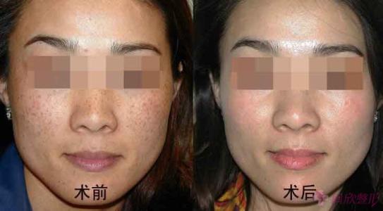 2023上海熱門整形美容機構前十強推薦！讓您美美噠！