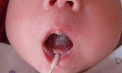 上海哪家醫(yī)院去狐臭好？專家推薦的治療狐臭最佳醫(yī)院大揭秘！