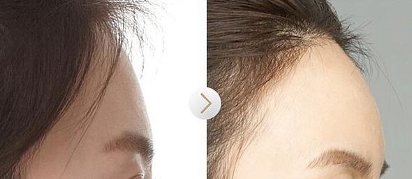 南通整形隆胸醫(yī)院哪家好？南通市整形美容醫(yī)院哪家做整容效果好？