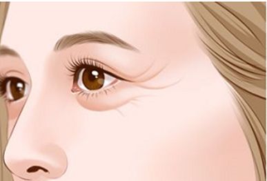 紋眼線美容術(shù)何時(shí)顯示真實(shí)魅力？效果持續(xù)多長(zhǎng)時(shí)間？