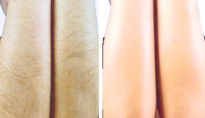 泰安哪家假體隆胸醫(yī)院好？醫(yī)生經(jīng)驗(yàn)豐富，手術(shù)技術(shù)專業(yè)的推薦匯總