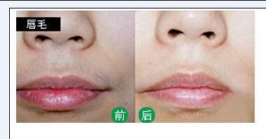 株洲哪家醫(yī)院的美容科好？美容項(xiàng)目有哪些選擇？