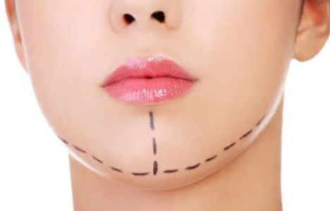 廣州修復(fù)雙眼皮哪家好？選擇最適合您的雙眼皮修復(fù)醫(yī)院