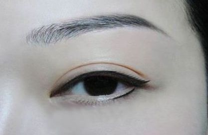 上海哪家雙眼皮美容醫(yī)院比較好？享譽口碑的推薦