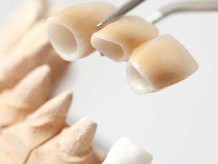 洛陽更靠譜的雙眼皮整形醫(yī)院盤點(diǎn)，資深醫(yī)師貼心呵護(hù)，豐富的臨床經(jīng)驗(yàn)帶給你完美雙眼皮效果