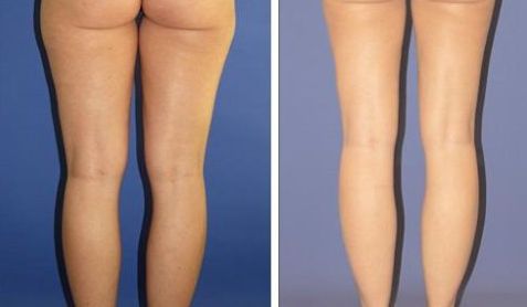 南昌整形美容科那家醫(yī)院好？2023南昌整形美容科頂級醫(yī)院推薦