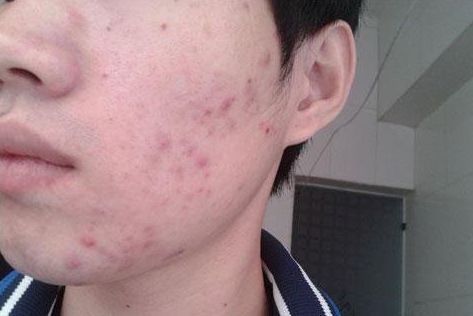 深圳整容界才子才女齊聚！隆鼻權(quán)威大神詳解！