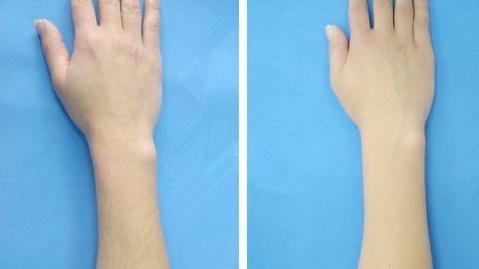 什么時間最適合進行跑步減肥？