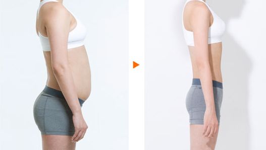 2023年，成都市內(nèi)更受推崇的去脂醫(yī)院排名榜單公布！