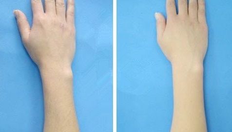 合肥哪家玻尿酸下巴好？權(quán)威醫(yī)生推薦的合肥玻尿酸下巴整形醫(yī)院排行榜