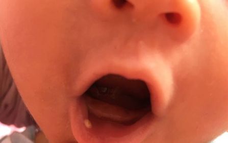 探尋青島吸脂整形專業(yè)醫(yī)院，解答哪家醫(yī)院在吸脂整形領(lǐng)域有良好口碑？