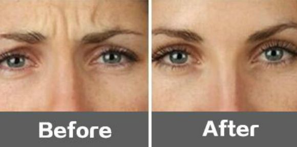 廣州十佳V提面部提升整形醫(yī)院，煥顏新生