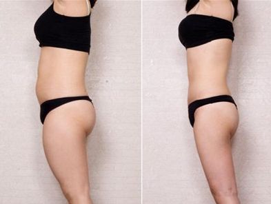 2023年度最新安慶地區(qū)整形醫(yī)院推薦