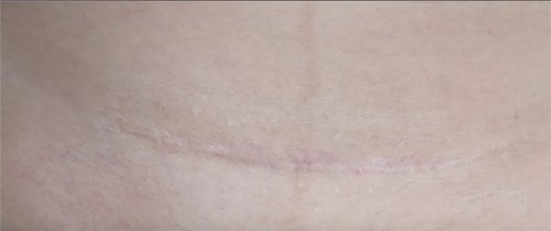 減脂瘦腿的方法果真有效嗎？最新瘦腿技巧大揭秘！