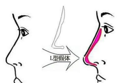 徐州美特萊斯醫(yī)療美容整形門診部醫(yī)生技術高超嗎？美容效果好嗎？