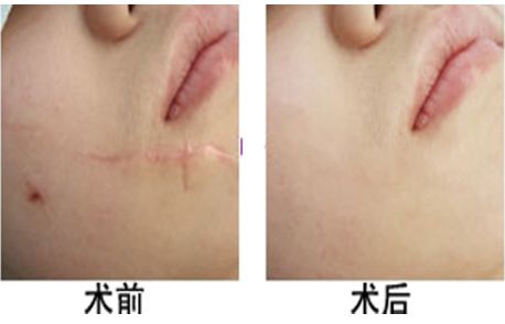 最佳隱形石家莊整形醫(yī)院排名揭秘｜高度贊譽(yù)的醫(yī)療機(jī)構(gòu)名單公開