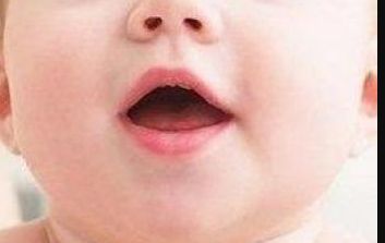 太原哪家醫(yī)院做激光祛痘好？醫(yī)院選擇攻略解析來(lái)了！