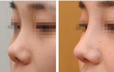 徐州熱門(mén)整形醫(yī)院解析：技術(shù)精湛，讓你驚艷全城，廣受歡迎！