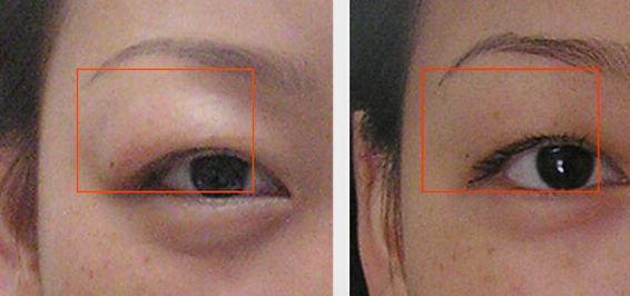 貴陽(yáng)胸部整形美容醫(yī)院推薦！醫(yī)療實(shí)力與特色出眾！一文了解！