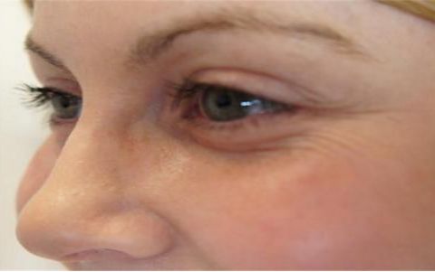 成都疤痕哪家醫(yī)院效果好？實(shí)力醫(yī)院推薦，讓你恢復(fù)自信！