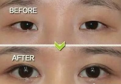 揭秘安吉麗娜朱莉整容傳聞：真相到底如何？