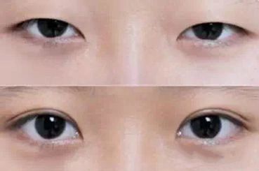 揭秘尹正整容真相！身邊相貌大變引發(fā)猜測(cè)