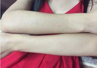 杭州激光整形哪家醫(yī)院好？綜合排名前三的杭州激光整形醫(yī)院推薦