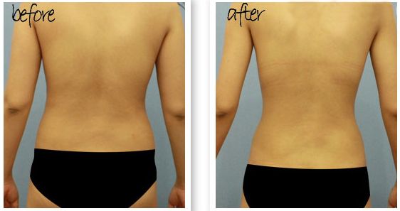 【2023年北京激光美容科十強(qiáng)推薦】哪家激光美容科好？