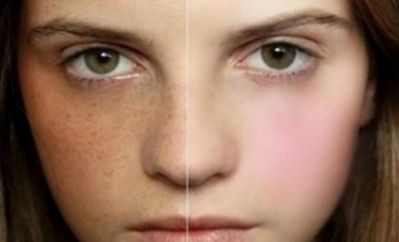 北京明星整形醫(yī)院哪家好？實(shí)力對(duì)比，選擇最適合自己的明星整形醫(yī)院