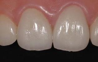 昆明醫(yī)科大學(xué)第一附屬醫(yī)院整形科到底有哪些備受矚目的醫(yī)生口碑資料？是誰充滿人氣呢？