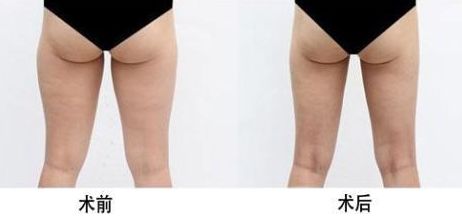 南京雙眼皮修復(fù)醫(yī)院哪家好？權(quán)威醫(yī)院排行榜揭曉！