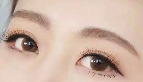 寧波哪家醫(yī)療美容醫(yī)院重瞼失敗修復(fù)效果好？2023年排名榜前幾家醫(yī)療整形醫(yī)院強(qiáng)強(qiáng)對比！