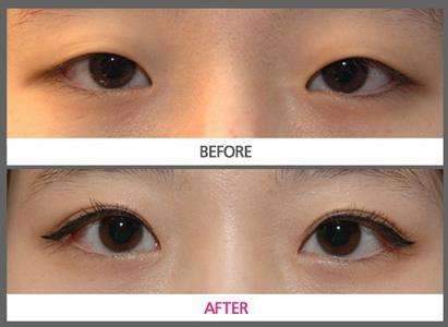 2023年晉中疤痕去除首選，彩光面部修復(fù)效果一覽無(wú)余！