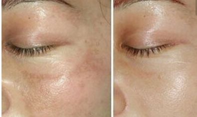 2023南陽(yáng)局部鼻整形治療機(jī)構(gòu)推薦