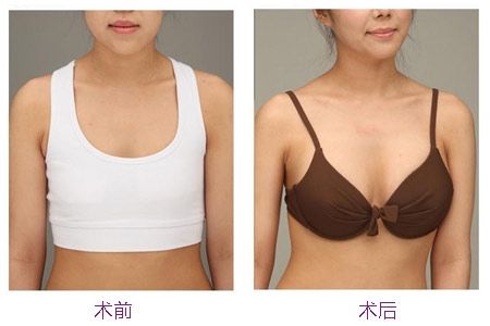 2023哪幾家四平面部精細(xì)雕刻整形醫(yī)院最具權(quán)威性？四平面部注射精細(xì)雕刻醫(yī)療專家推薦前十強(qiáng)！