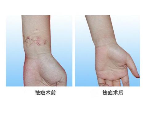 綿陽哪些醫(yī)院的肋骨隆鼻術(shù)效果好？2023綿陽肋骨隆鼻術(shù)榜單公布十佳醫(yī)院全面評估！