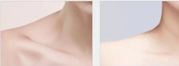 如何選擇中國最好的整形醫(yī)院？