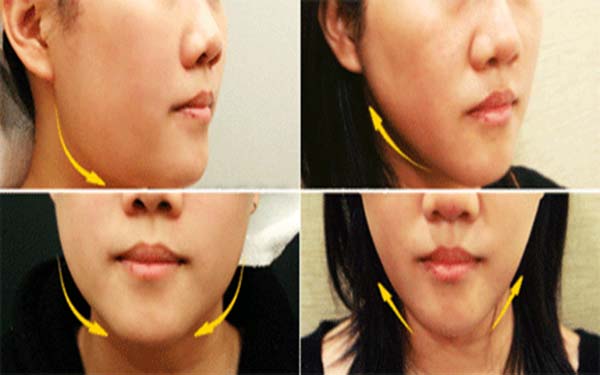 2023年臺州哪家面部吸脂整形醫(yī)院受到口碑好評？敬請參考推薦前十家正規(guī)醫(yī)院