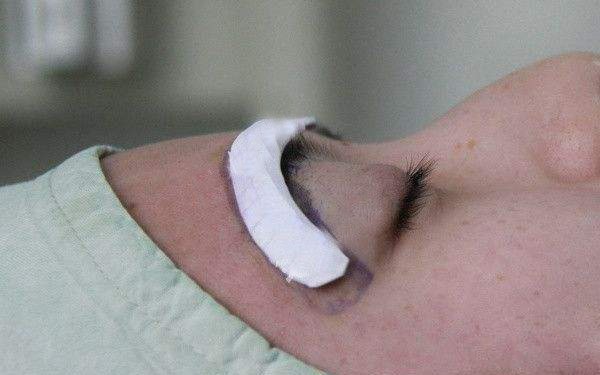 如何正確護(hù)理術(shù)后雙眼皮手術(shù)？