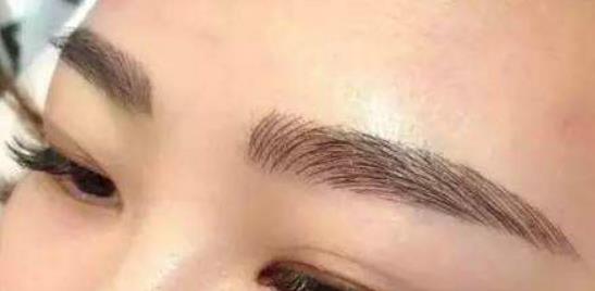 天使隆鼻幾天可消腫？恢復(fù)期及注意事項大公開！