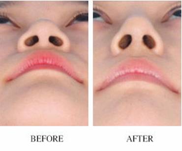 上海2023年比較好的自體脂肪注射眼睛細(xì)紋整形醫(yī)院排名TOP10，不容錯過！