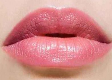 深圳哪家醫(yī)院能夠有效治療疤痕？