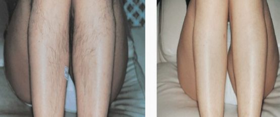 深圳有哪些治鼻子好的醫(yī)院？