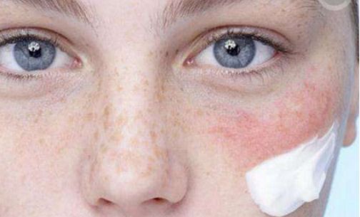 揭秘李玲玉是否真的進行了整容手術？