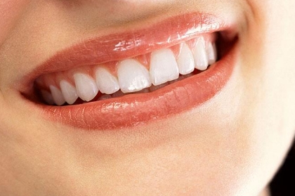 牙齒種植的價(jià)格是多少？種植牙的好處有哪些？