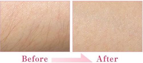 西安唇腭裂手術(shù)醫(yī)院排名及費(fèi)用對(duì)比，哪家醫(yī)院好