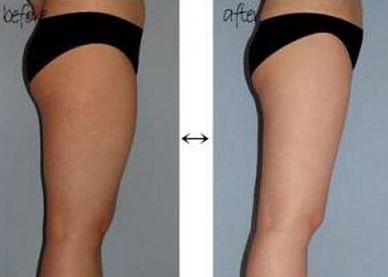 昆明做雙眼皮技術哪家好，最受用戶歡迎的昆明雙眼皮技術推薦有哪些？