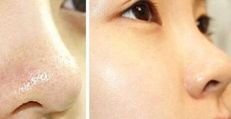 成都嘴型整形哪家醫(yī)院好？探尋敲定你最適合的整形中心