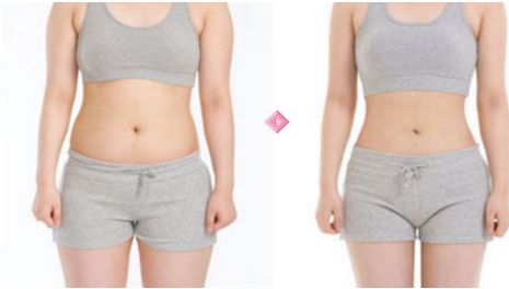 贛州哪家醫(yī)院做雙眼皮好